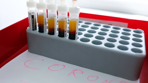 Der er færre og færre smittet med coronavirus, der hvert døgn dør i Danmark. (Arkivfoto)