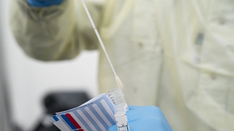 Verden over er der nu blevet bekræftet 25 millioner tilfælde af personer, der er testet positive for coronavirus. (Arkivfoto)