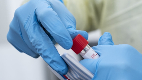 Myndighederne forsøger med flere tiltag at overvåge smitten med coronavirus i Danmark. (Arkivfoto)