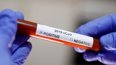 Danmark har et beredskab klar, hvis en eller flere hjemvendte danskere fra Hubei-provinsen mod forventning skulle udvise symptomer på smitte med coronavirus. (Arkivfoto)