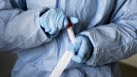 Ifølge Dansk Folkeparti burde man have haft en klarere strategi for blandt andet anskaffelse af test og værnemidler. (Arkivfoto)