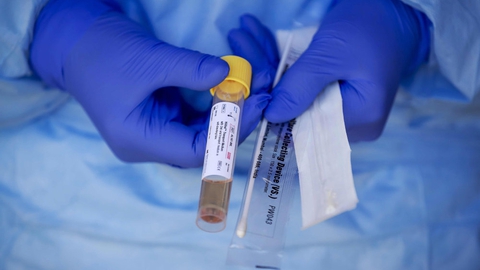 SSI arbejder nu på at få udbredt metoden hurtigst muligt, så andre også kan få gavn af den. Derfor bliver den offentliggjort online og sendt per mail til europæiske laboratorier, som frit kan anvende den. (Arkivfoto).