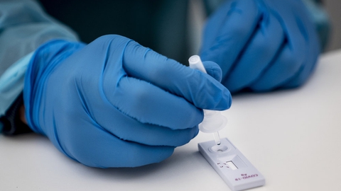 SSI forklarer på sin hjemmeside, at der er flere gode grunde til at dobbelttjekke svarene fra lyntest, som også er kaldet antigentest. (Arkivfoto).