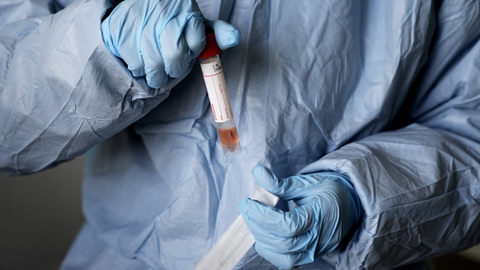 Regionerne nåede torsdag det ønskede niveau om at teste flere end 5000 personer for coronavirus i døgnet. På billedet viser sundhedspersonale på Roskilde Sygehus en coronatest. (Arkivfoto).