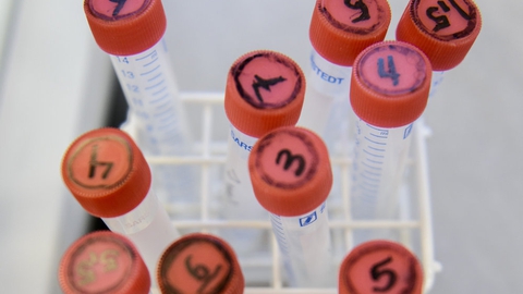 Under den midlertidige nedlukning af fertilitetsklinikker er nogle kvinder kommet i klemme, fordi de er fyldt 41 år - og dermed har de mistet retten til fertilitetsbehandling på offentlige klinikker. (Arkivfoto)